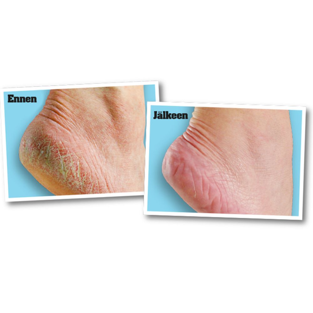 O'Keeffe's Healthy Feet jalkavoide 96 g