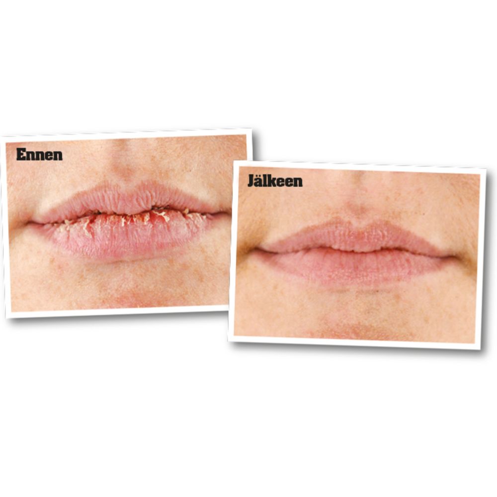 O'Keeffe's Lip Repair huulivoide